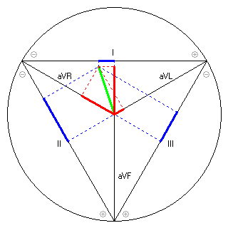 Vektor im Einthoven-Dreieck