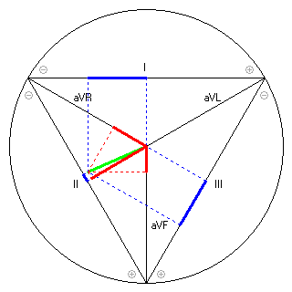 Vektor im Einthoven-Dreieck