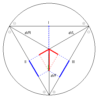 Vektor im Einthoven-Dreieck