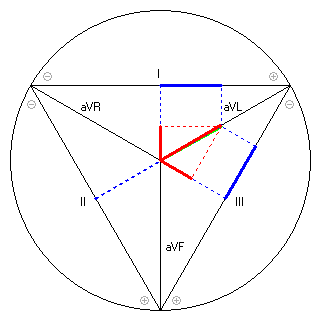 Vektor im Einthoven-Dreieck