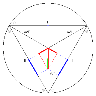 Vektor im Einthoven-Dreieck