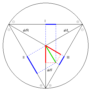 Vektor im Einthoven-Dreieck