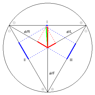 Vektor im Einthoven-Dreieck