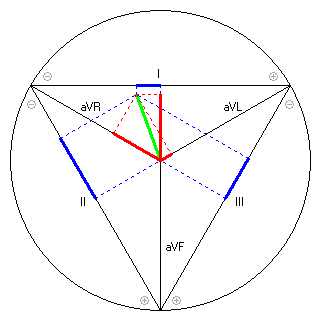 Vektor im Einthoven-Dreieck