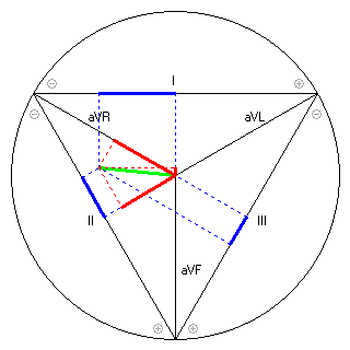 Vektor im Einthoven-Dreieck