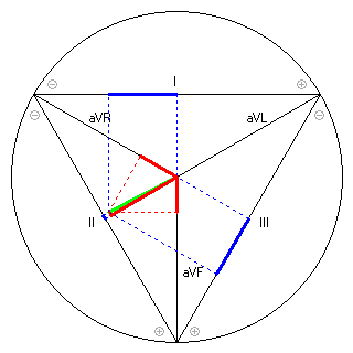 Vektor im Einthoven-Dreieck