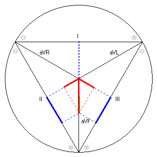 Vektor im Einthoven-Dreieck