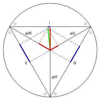 Vektor im Einthoven-Dreieck