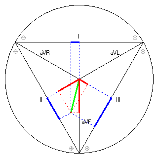 Vektor im Einthoven-Dreieck