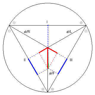 Vektor im Einthoven-Dreieck