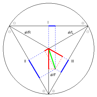 Vektor im Einthoven-Dreieck