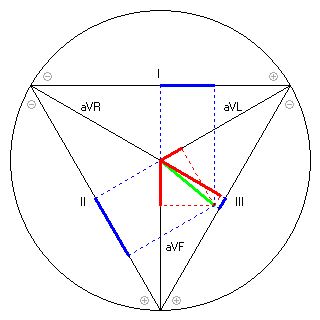 Vektor im Einthoven-Dreieck