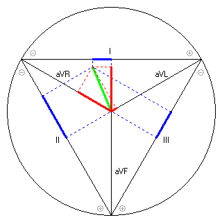 Vektor im Einthoven-Dreieck