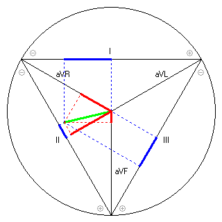 Vektor im Einthoven-Dreieck