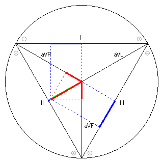 Vektor im Einthoven-Dreieck