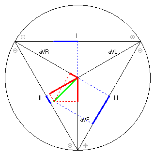 Vektor im Einthoven-Dreieck