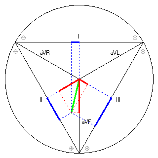 Vektor im Einthoven-Dreieck