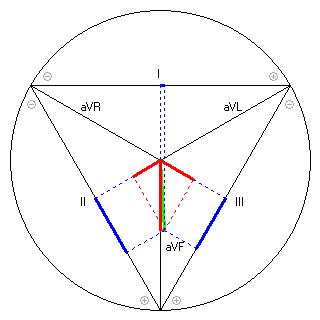 Vektor im Einthoven-Dreieck