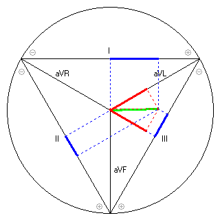 Vektor im Einthoven-Dreieck