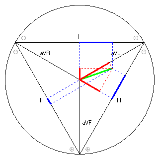 Vektor im Einthoven-Dreieck