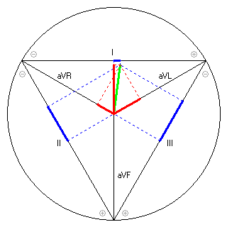 Vektor im Einthoven-Dreieck