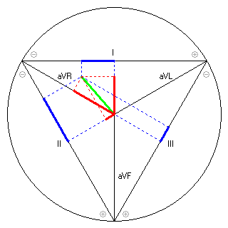 Vektor im Einthoven-Dreieck