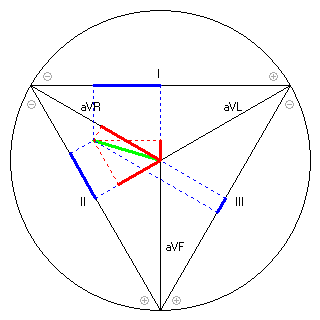 Vektor im Einthoven-Dreieck