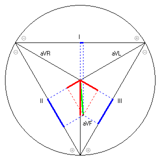 Vektor im Einthoven-Dreieck