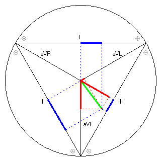 Vektor im Einthoven-Dreieck