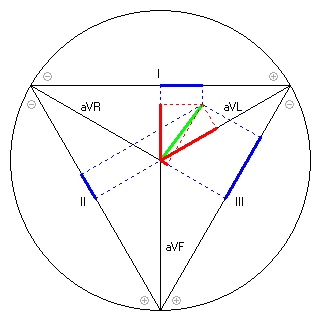 Vektor im Einthoven-Dreieck