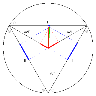 Vektor im Einthoven-Dreieck