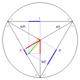 Vektor im Einthoven-Dreieck