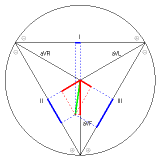 Vektor im Einthoven-Dreieck